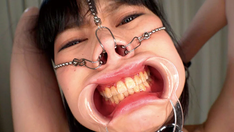 わさび 開口具 鼻フック